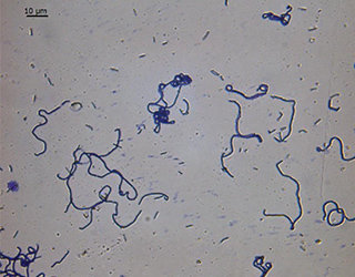 lactobacillus bulgaricus slide